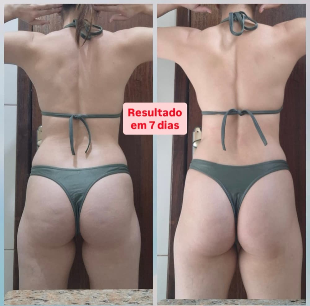 Priscila — resultado em 7 dias